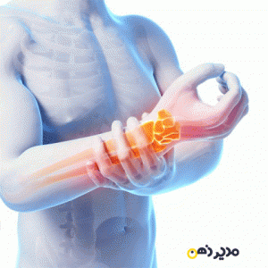سه تمرین برای جلوگیری از درد مچ دست و تونل کارپال-مدیرذهن